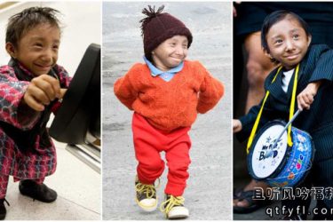 世界上最矮的人去世终年27岁 - 逸尤格