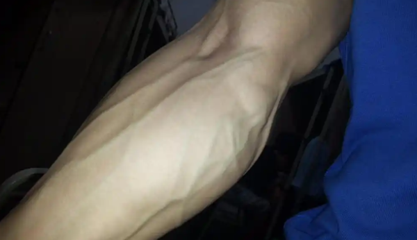 为什么有的人手臂青筋凸起,有人却看不见青筋? - 逸尤格