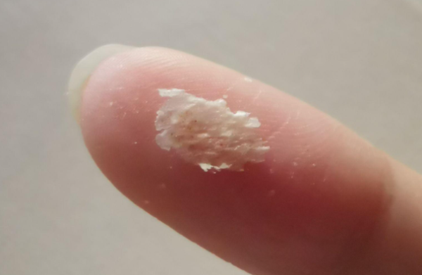 头皮上抠下来一块一块的是什么?能抠吗? - 逸尤格
