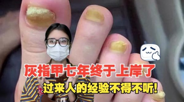 为什么人类会长灰指甲? - 逸尤格