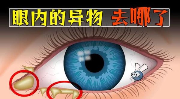飞进眼睛的异物,消失去哪了? - 逸尤格